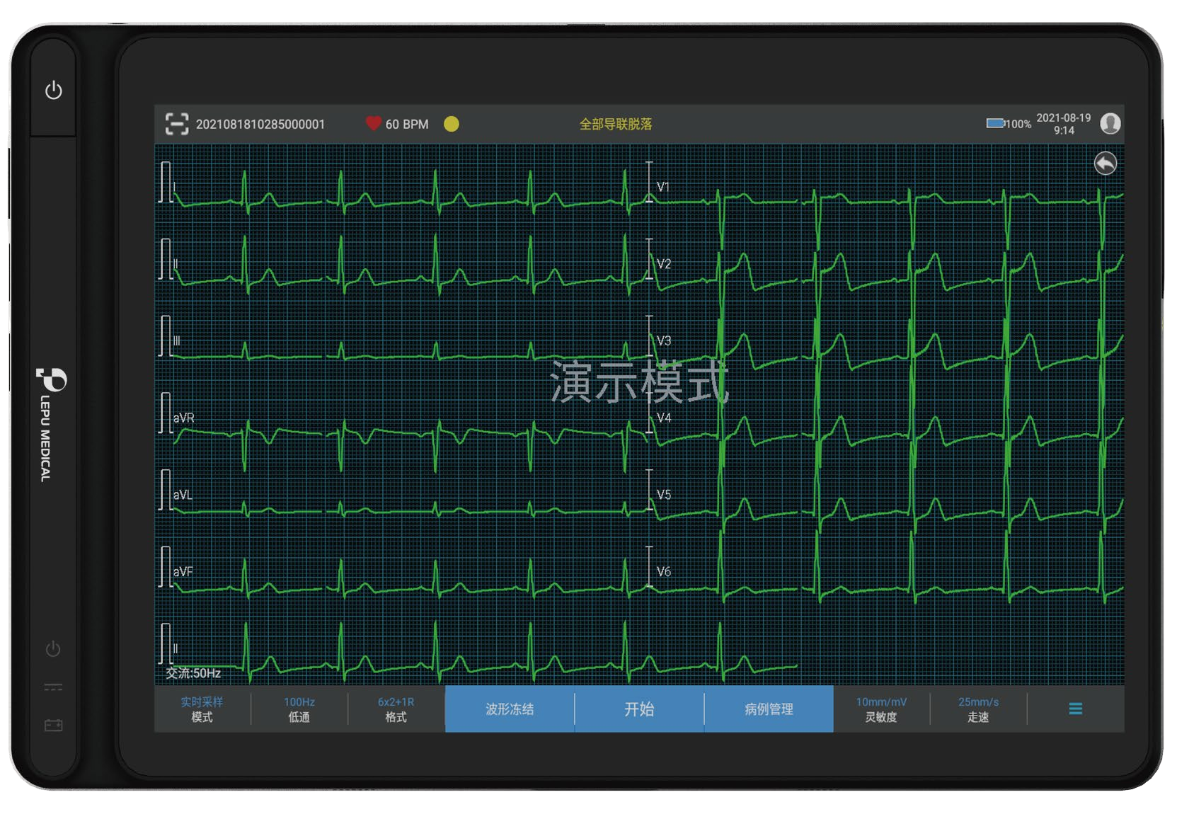 乐普AI便携式心电图机 乐普AI便携式心电图机