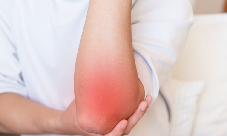 专家共识|聚焦式体外冲击波治疗肌腱末端病,9 类疾病标准化方案出炉